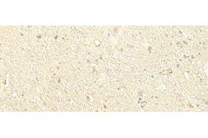 Immunohistochemistry of paraffin-embedded Human brain tissue using SPIRE1 Polyclonal Antibody at dilution of 1:60(x200) (SPIRE1 antibody)