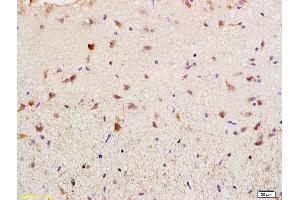 Formalin-fixed and paraffin embedded rat brain labeled with Rabbit Anti BAG2 Polyclonal Antibody, Unconjugated (ABIN755347) at 1:200 followed by conjugation to the secondary antibody and DAB staining (BAG2 antibody  (AA 151-211))