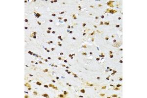 Immunohistochemistry of paraffin-embedded mouse brain using CCAR2 antibody (ABIN2563550) at dilution of 1:100 (40x lens). (CCAR2 antibody)