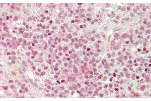 Detection of CXCL2 in Human Spleen Tissue using Polyclonal Antibody to Chemokine (C-X-C Motif) Ligand 2 (CXCL2) (CXCL2 antibody  (AA 34-107))