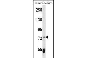 ZBTB39 Antibody (Center) (ABIN1538134 and ABIN2849854) western blot analysis in mouse cerebellum tissue lysates (35 μg/lane). (ZBTB39 antibody  (AA 231-258))