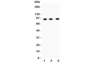 Western blot testing of NEDD9 antibody and Lane 1:  Jurkat;  2: CEM;  3: Raji lysate. (NEDD9 antibody)