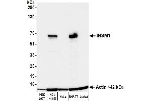 Western Blotting (WB) image for anti-Insulinoma-Associated 1 (INSM1) (AA 75-125) antibody (ABIN7795670) (Recombinant INSM1 antibody  (AA 75-125))
