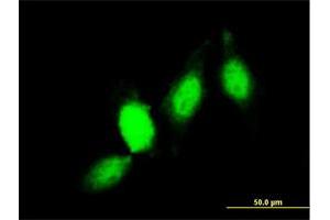 Immunofluorescence of monoclonal antibody to GSTP1 on HeLa cell. (GSTP1 antibody  (AA 1-210))