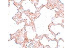 Immunohistochemical staining of rat lung tissue with SGK493 polyclonal antibody  at 25 ug/mL dilution. (PKDCC antibody)