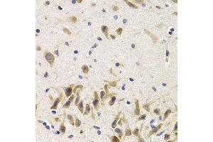 Immunohistochemistry of paraffin-embedded rat brain using UAP1 antibody at dilution of 1:200 (400x lens).