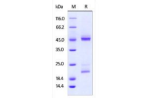 Mouse IL-23 alpha & IL-12 beta Heterodimer Protein on SDS-PAGE under reducing (R) condition.
