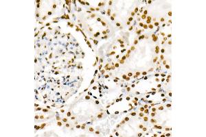 Immunohistochemistry of paraffin-embedded rat kidney using Phospho-POLR2A CTD-S2 Rabbit mAb  at dilution of 1:200 (40x lens).