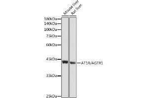 Western blot analysis of extracts of various cell lines, using R/ antibody (ABIN6133546, ABIN6136653, ABIN6136654 and ABIN6218484) at 1:1000 dilution.