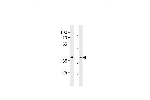 GPR4 Antibody (Center) (ABIN1881386 and ABIN2843366) western blot analysis in WiDr cell line and rat liver tissue lysates (35 μg/lane). (GPR4 antibody  (AA 196-224))