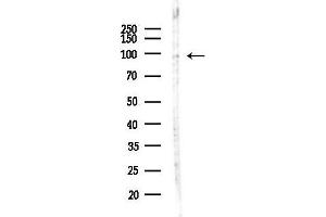 anti-Transient Receptor Potential Cation Channel, Subfamily C, Member 3 (TRPC3) (C-Term) antibody
