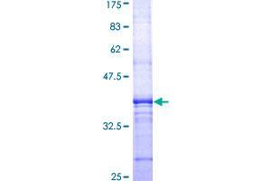Image no. 1 for Transferrin Receptor (p90, CD71) (TFRC) (AA 68-168) protein (GST tag) (ABIN1322588)