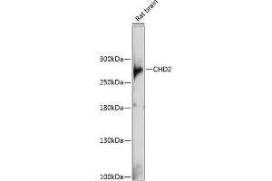 Western blot analysis of extracts of rat brain, using CHD2 antibody (ABIN6133621, ABIN6138503, ABIN6138507 and ABIN6217491) at 1:1000 dilution. (CHD2 antibody  (C-Term))