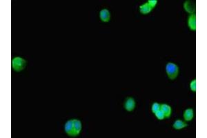 Immunofluorescent analysis of HepG2 cells using ABIN7172549 at dilution of 1:100 and Alexa Fluor 488-congugated AffiniPure Goat Anti-Rabbit IgG(H+L) (GATA5 antibody  (AA 336-397))