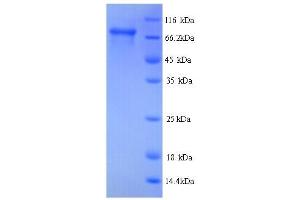 SDS-PAGE (SDS) image for Hydroxysteroid (17-Beta) Dehydrogenase 4 (HSD17B4) (AA 1-736), (full length) protein (His tag) (ABIN5713516)