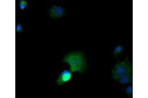 Image no. 2 for anti-Cancer/testis Antigen 1B (CTAG1B) antibody (ABIN1499889) (CTAG1B antibody)