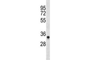 Aurkb antibody western blot analysis in Ramos lysate. (Aurora Kinase B antibody  (AA 84-111))