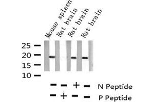 Western blot analysis of Phospho-Stathmin 1 (Ser15) expression in various lysates