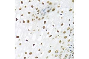 Immunohistochemistry of paraffin-embedded human esophagus using PTBP1 antibody (ABIN5995415) at dilution of 1/100 (40x lens). (PTBP1 antibody)