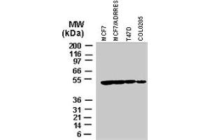 Western blot analysis of BIRC4 in various tumor cell lines recombinant BIRC4 polyclonal antibody  at 1 : 2000. (XIAP antibody)
