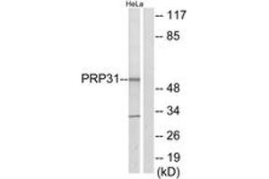 Western blot analysis of extracts from HeLa cells, using PRP31 Antibody. (PRPF31 antibody  (AA 331-380))