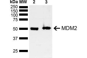 Western blot analysis of Mouse, Rat Brain showing detection of ~40 kDa MDM2 protein using Rabbit Anti-MDM2 Polyclonal Antibody (ABIN5667992). (MDM2 antibody  (AA 100-200))