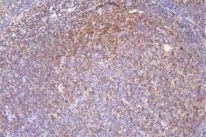 IHC analysis of DCK using anti-DCK antibody (ABIN7600254).