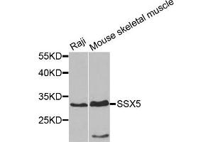 Western blot analysis of extracts of Raji and mouse skeletal muscle cells, using SSX5 antibody. (SSX5 antibody)