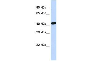 Host:  Rabbit  Target Name:  ZNF773  Sample Type:  Hela whole cell lysates  Antibody Dilution:  1.