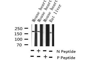 Western blot analysis of Phospho-HER2 (Tyr877) expression in various lysates (ErbB2/Her2 antibody  (pTyr877))