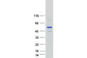 Validation with Western Blot (SPTLC1 Protein (Transcript Variant 1) (Myc-DYKDDDDK Tag))