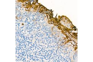 Immunohistochemistry of paraffin-embedded Human tonsil (negative control sample) using CE antibody (ABIN7266084) at dilution of 100 (40x lens). (CEACAM5 antibody)