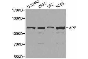 Western blot analysis of extracts of various cell lines, using APP antibody. (beta Amyloid antibody)