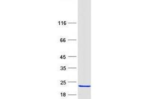 Western Blotting (WB) image for Ubiquitin-Conjugating Enzyme E2B (UBE2B) protein (Myc-DYKDDDDK Tag) (ABIN2734782)