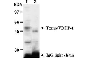 Western Blotting (WB) image for anti-Thioredoxin Interacting Protein (TXNIP) antibody (ABIN567794) (TXNIP antibody)
