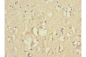 Immunohistochemistry of paraffin-embedded human brain tissue using ABIN7152777 at dilution of 1:100 (FGF12 antibody  (AA 1-181))