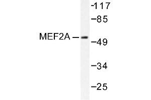 Image no. 1 for anti-Myocyte Enhancer Factor 2A (MEF2A) antibody (ABIN271871) (MEF2A antibody)