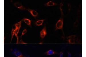 Immunofluorescence analysis of NIH-3T3 cells using TSC1 Polyclonal Antibody at dilution of 1:100 (40x lens). (TSC1 antibody)