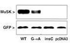 MUSK antibody  (AA 35-65)