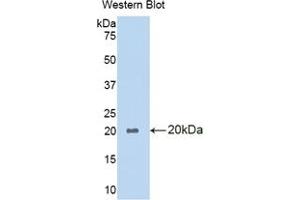 Western blot analysis of the recombinant protein. (PLA1A antibody  (AA 309-452))