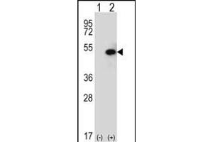 Western blot analysis of SPHK1 (arrow) using rabbit polyclonal SPHK1 Antibody (C-term ) (ABIN652302 and ABIN2837969). (SPHK1 antibody  (C-Term))