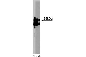 Western Blotting (WB) image for anti-Protein Phosphatase 2, Regulatory Subunit B', alpha (PPP2R5A) (AA 1-162) antibody (ABIN968065) (PPP2R5A antibody  (AA 1-162))