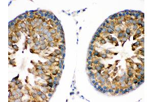 TRPM5 was detected in paraffin-embedded sections of rat testis tissues using rabbit anti- TRPM5 Antigen Affinity purified polyclonal antibody at 1 μg/mL. (TRPM5 antibody  (AA 1021-1108))