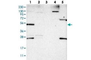 Western blot analysis of Lane 1: RT-4, Lane 2: U-251 MG, Lane 3: Human Plasma, Lane 4: Liver, Lane 5: Tonsil with DDX25 polyclonal antibody .