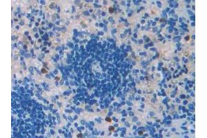 DAB staining on IHC-P; Samples: Rat Spleen Tissue (TGFB2 antibody  (AA 331-442))