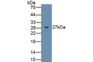Detection of Recombinant ADAMTS9, Human using Monoclonal Antibody to A Disintegrin And Metalloproteinase With Thrombospondin 9 (ADAMTS9) (ADAMTS9 antibody  (AA 1727-1935))