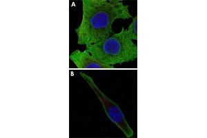 Confocal immunofluorescence analysis of PANC-1 (A) and SK-BR-3 (B) cells using SOD1 monoclonal antobody, clone 6F5  (green).