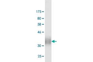 Western Blot detection against Immunogen (13. (PDCD1LG2 antibody  (AA 19-121))