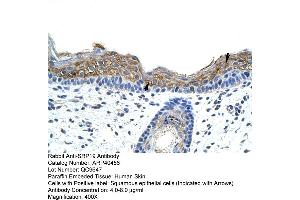 Rabbit Anti-SRAntibody  Paraffin Embedded Tissue: Human Skin Cellular Data: Squamous epithelial cells Antibody Concentration: 4. (SRP19 antibody  (Middle Region))