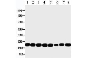Western Blotting (WB) image for anti-Non-Metastatic Cells 1, Protein (NM23A) Expressed in (NME1) (AA 137-152), (C-Term) antibody (ABIN3044197) (NME1 antibody  (C-Term))